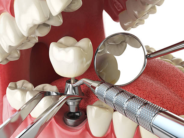 Best Emergency Dental Services for Seniors in South Huntington, NY
