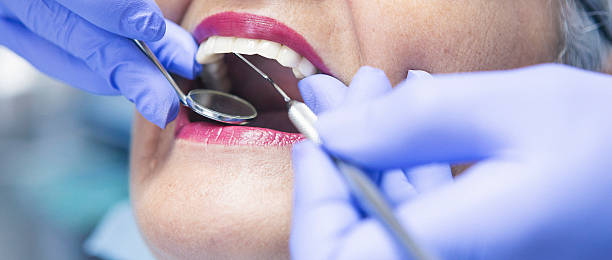 Best Broken or Cracked Tooth Emergency Dentist in South Huntington, NY